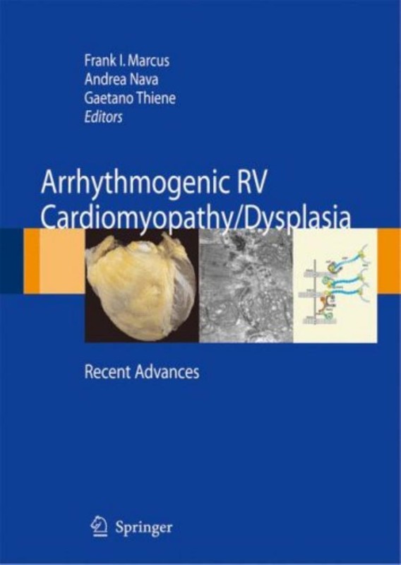Cover of Arrhythmogenic RV Cardiomyopathy Dysplasia
